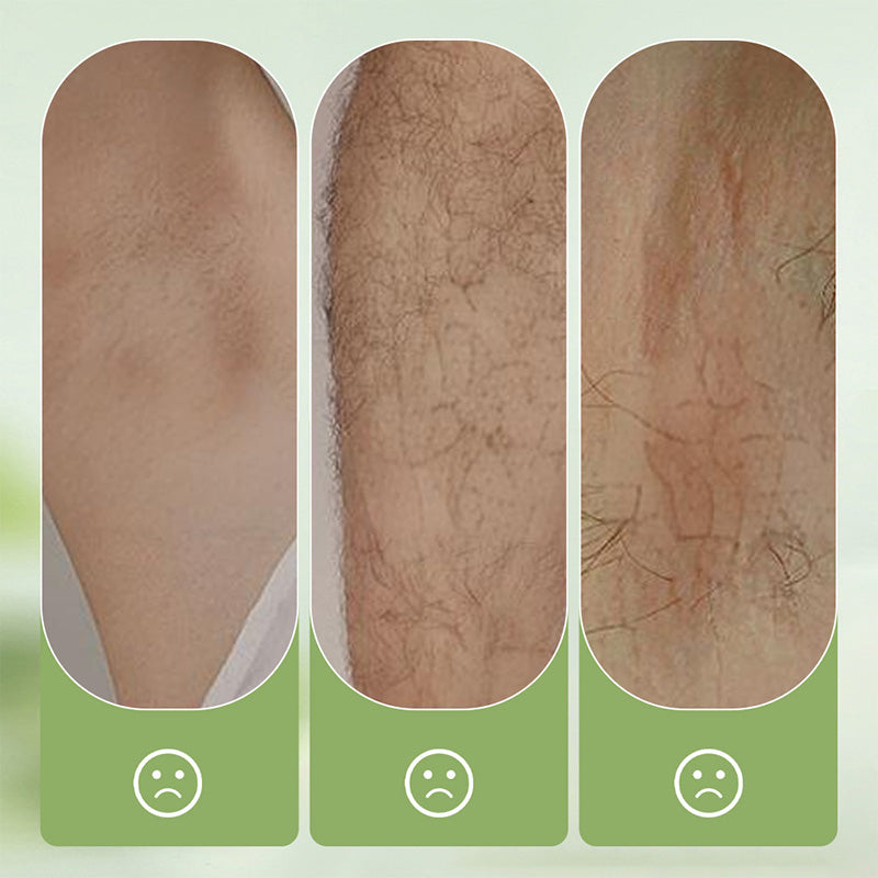 SilkEase — Unlock Effortless, Pain-Free Smoothness That Turns Heads - Esilora