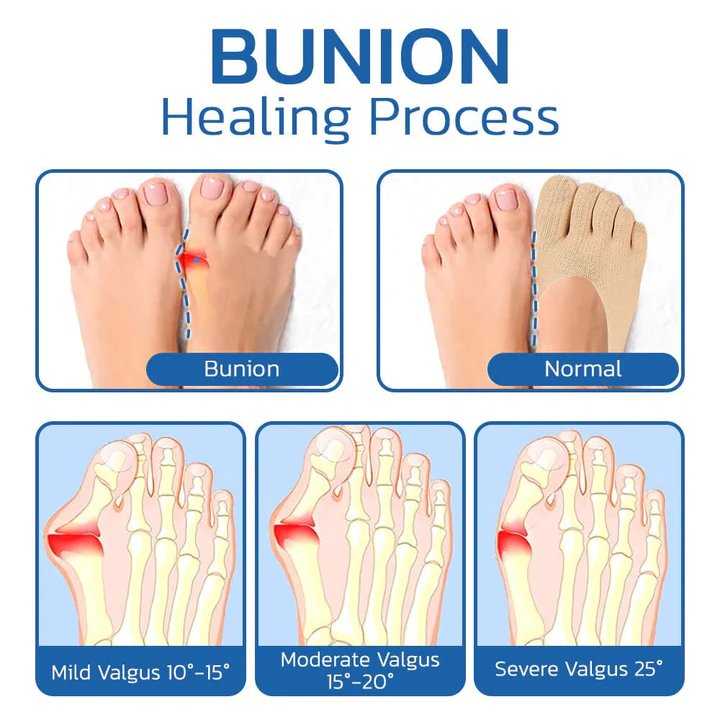 Pain-Free Walking with FlexStep – Safe for Every Step You Love - Esilora
