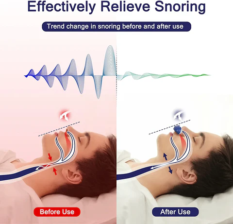 מכשיר CPAP נייד להקלה על נחירות ולטיפול בדום נשימה בשינה - Esilora