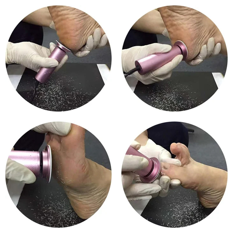 SilkStep Foot Treatment – Transforms Rough Feet into Smooth Comfort - Esilora