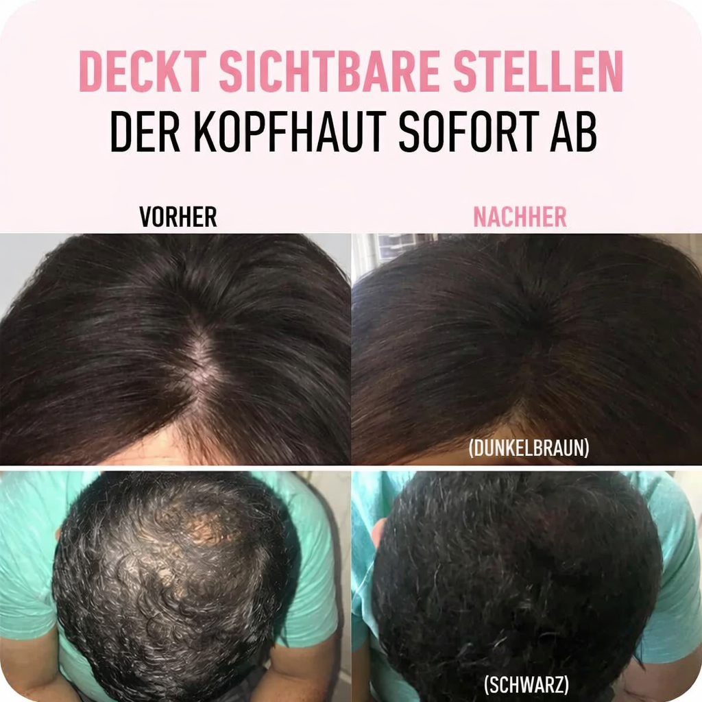 Rychlá úprava vlasové linie – dokonalá vlasová linie během několika sekund – Esilora