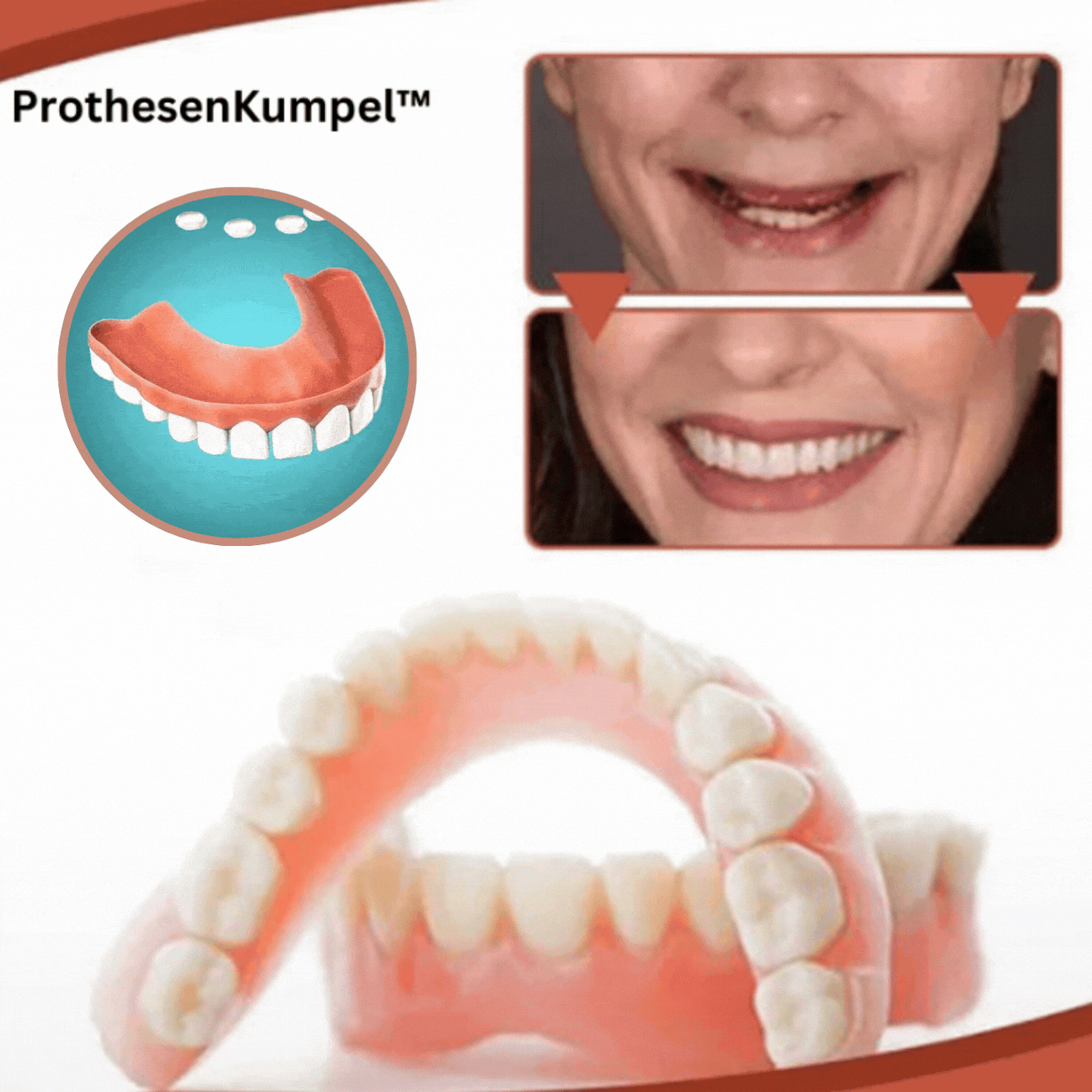 Set de prótesis de silicona biocompatible GlowSmile para un ajuste sin dolor y una sonrisa natural