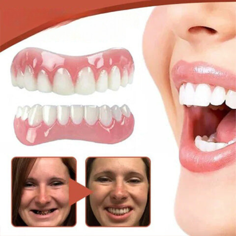 Set de prótesis de silicona biocompatible GlowSmile para un ajuste sin dolor y una sonrisa natural