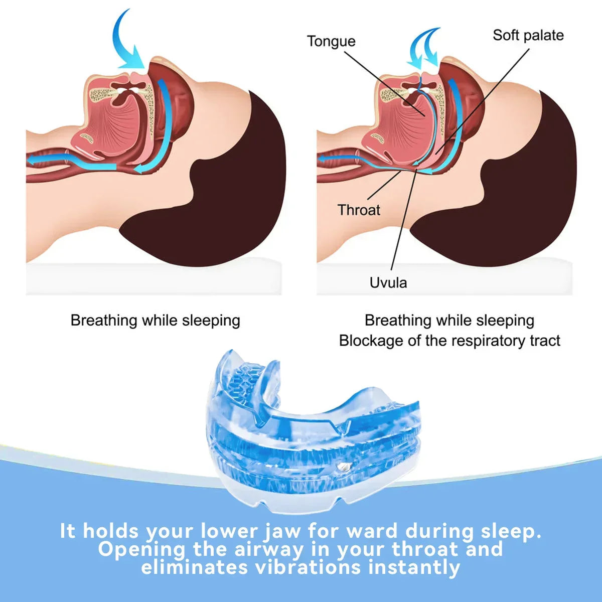 Anti-Snoring Mouthpiece for Comfortable Sleep