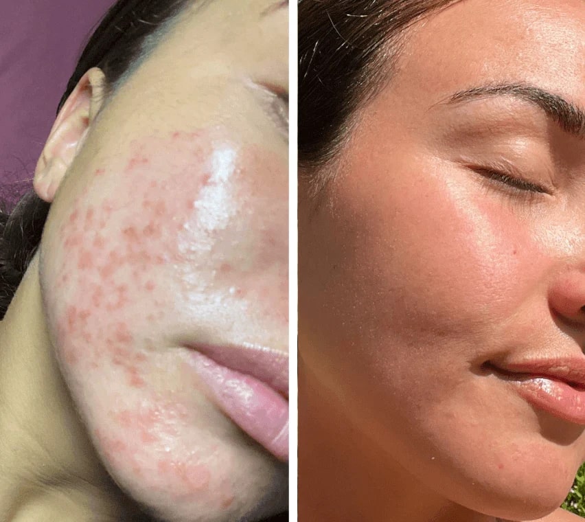 Trasforma la pelle spenta in una luminosità fresca e un delicato relax - Esilora