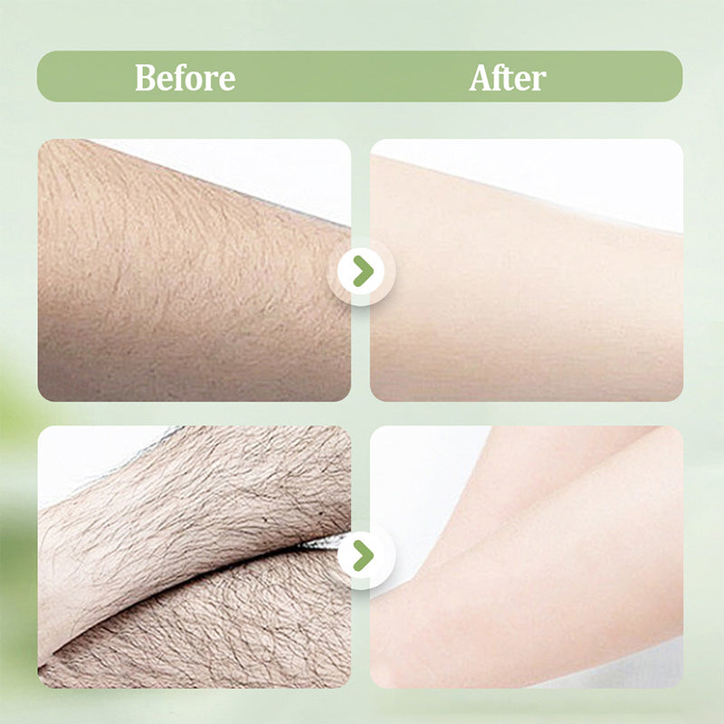 SilkEase — Unlock Effortless, Pain-Free Smoothness That Turns Heads - Esilora