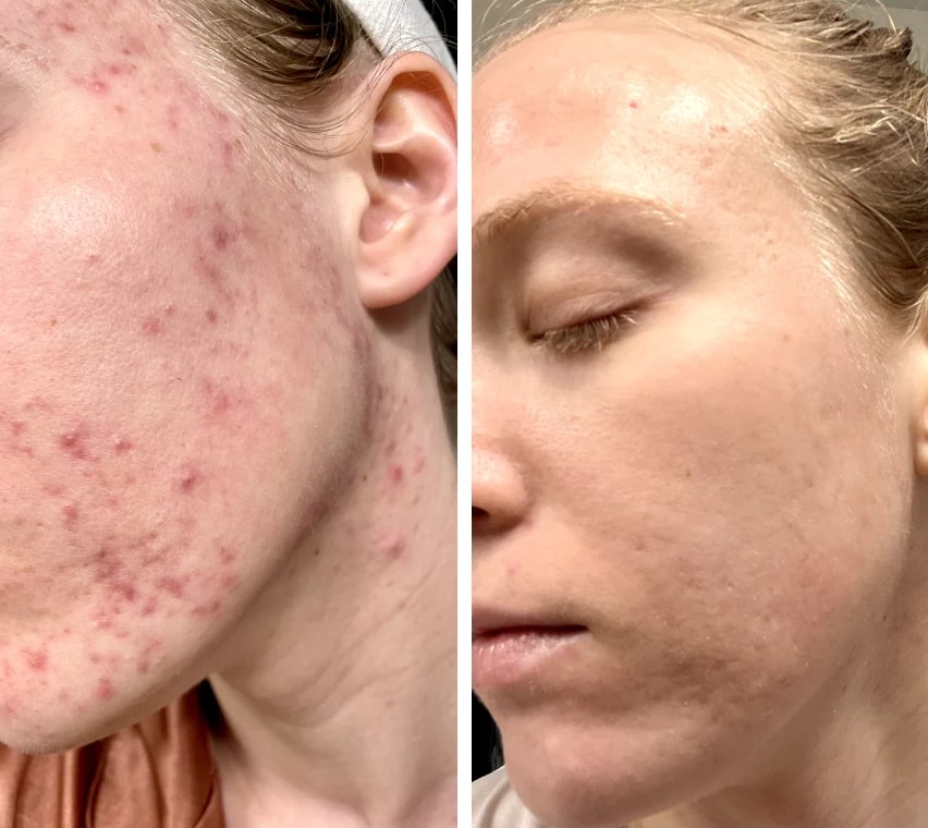 Trasforma la pelle spenta in una luminosità fresca e un delicato relax - Esilora