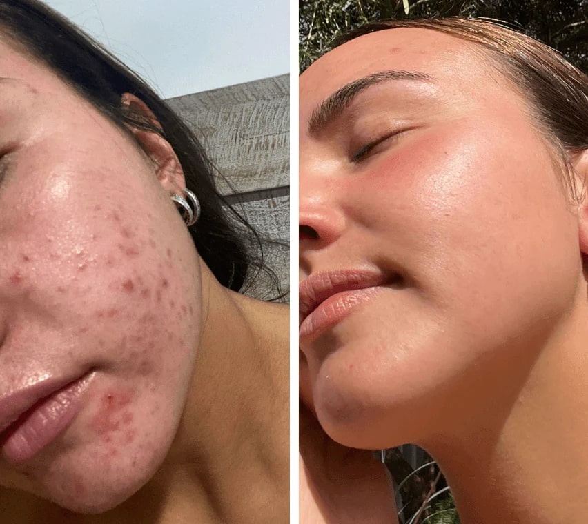 Trasforma la pelle spenta in una luminosità fresca e un delicato relax - Esilora