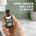 SilkNail — Bring Peeling, Discolored Nails Back to Healthy in Weeks - Esilora