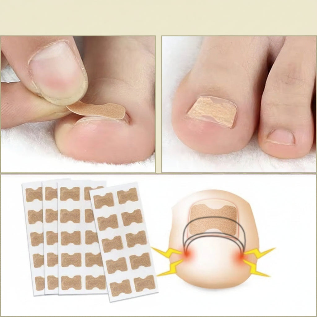 Self-Adhesive Nail Repair Patch — Continuous Tension Alignment