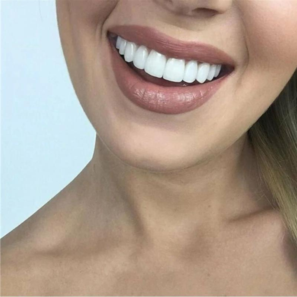 Tooth Repair NovaBright Smile Solution For A Perfect Smile